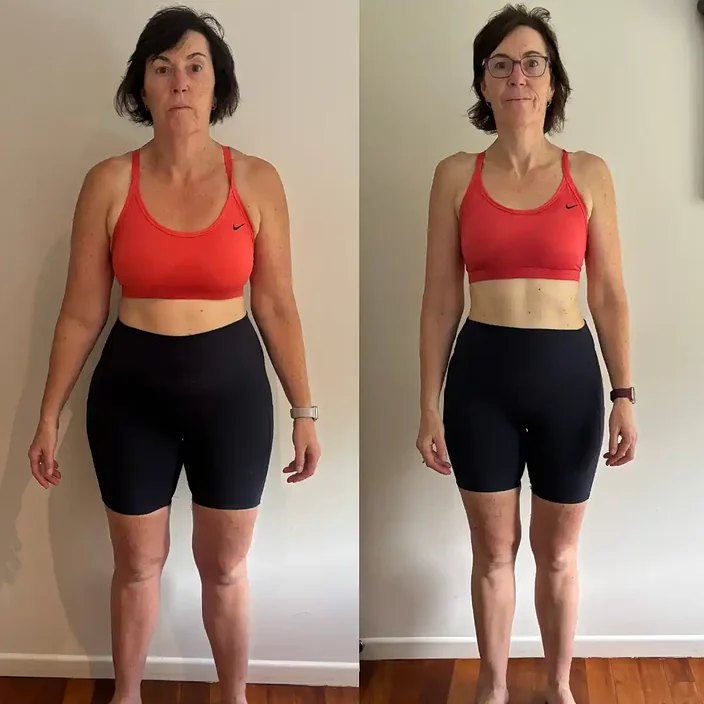 Kylie before and after her MLA transformation